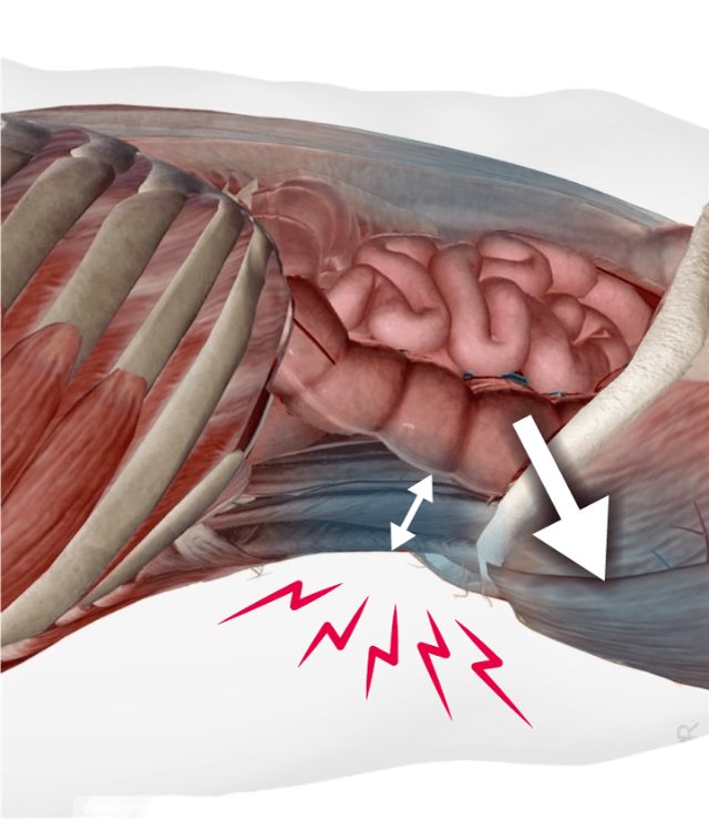 Anatomical view of the abdomen: sagging intestines press down toward the lower back