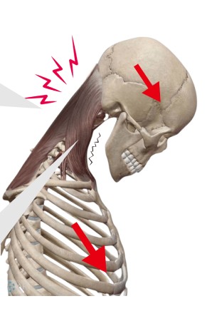 Skull and neck muscles seen from the side, head dropped forward